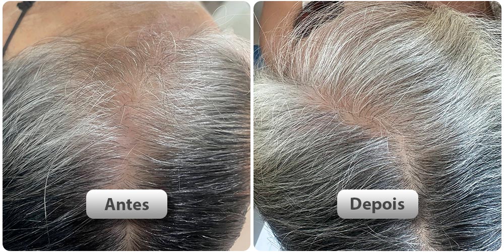antes-depois21