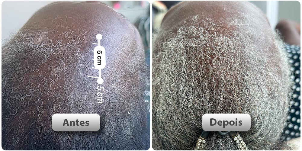 antes-depois4
